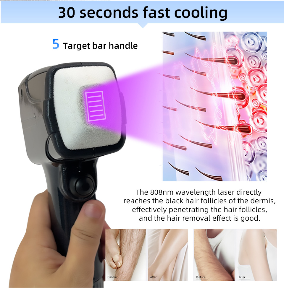 새로운 스타일의 휴대용 808 NM 웨이브 다이오드 레 - Industrial Laser Hair Removal Machine 리뷰 및 가격